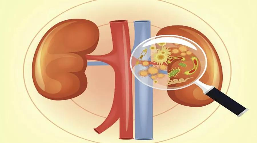 男孩尿液混浊的原因,吃鱼后尿液混浊是什么原因
