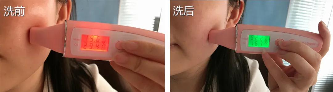 皮肤科医生都推荐的硫磺液体香皂,李佳琦5分钟卖了14406套