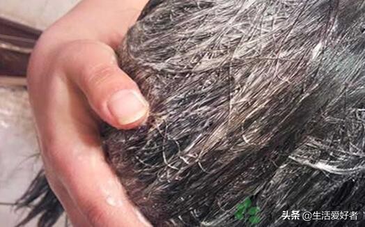 脱发侧柏叶洗头洗多久,脂溢性脱发是勤洗头还是不勤洗