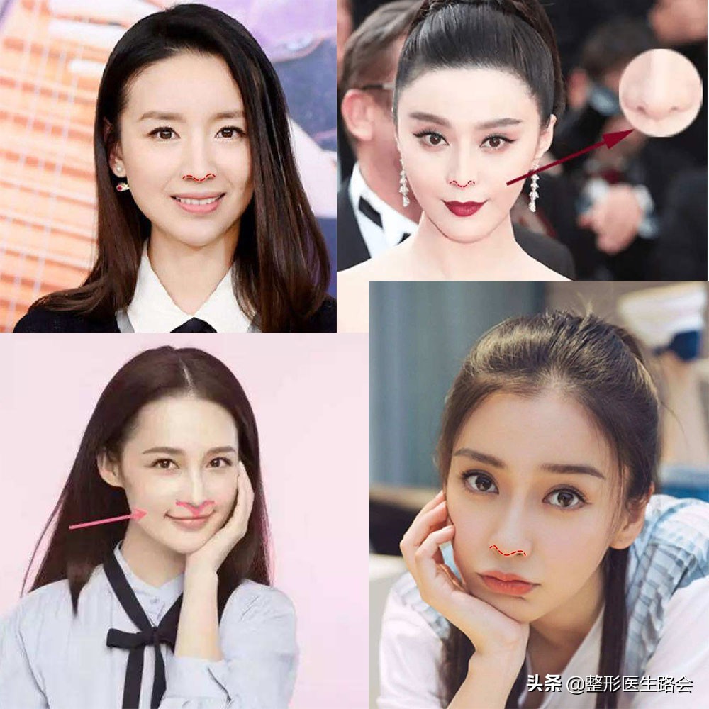 你的鼻子是怎样的,你的鼻子是什么的形状