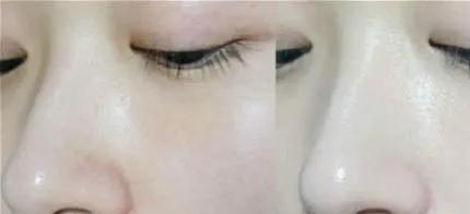 韩国后天率丹气垫,后天气丹气垫粉底