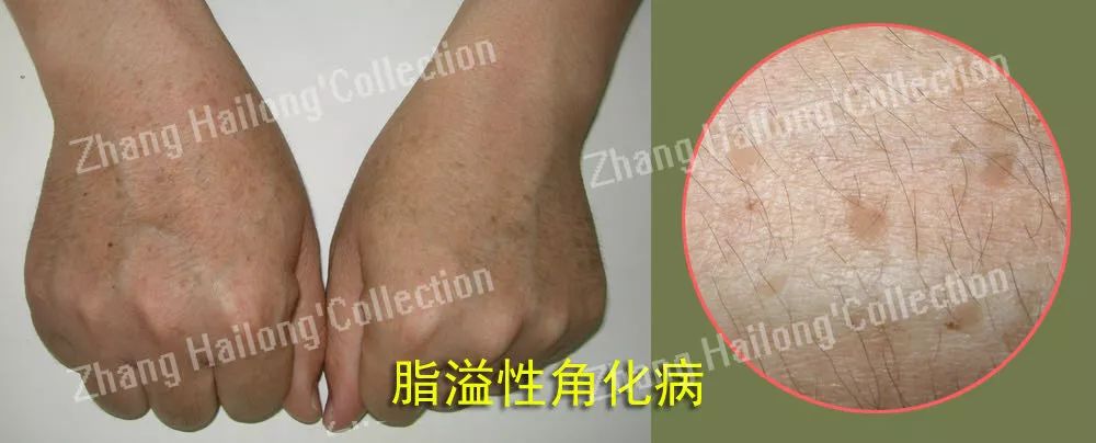 Ohno！老妈脸上出现了老年斑...