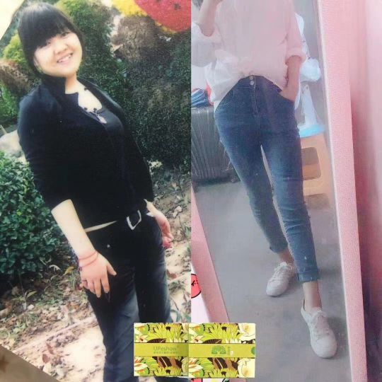 中萃片减肥副作用是什么最新,减肥黑科技是真的吗