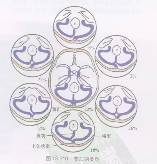学习|颅脑静脉解剖及引流