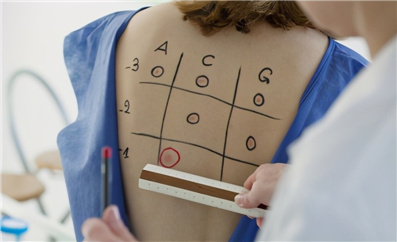 肩膀过敏反反复复几年了怎么根治,为什么我总是过敏