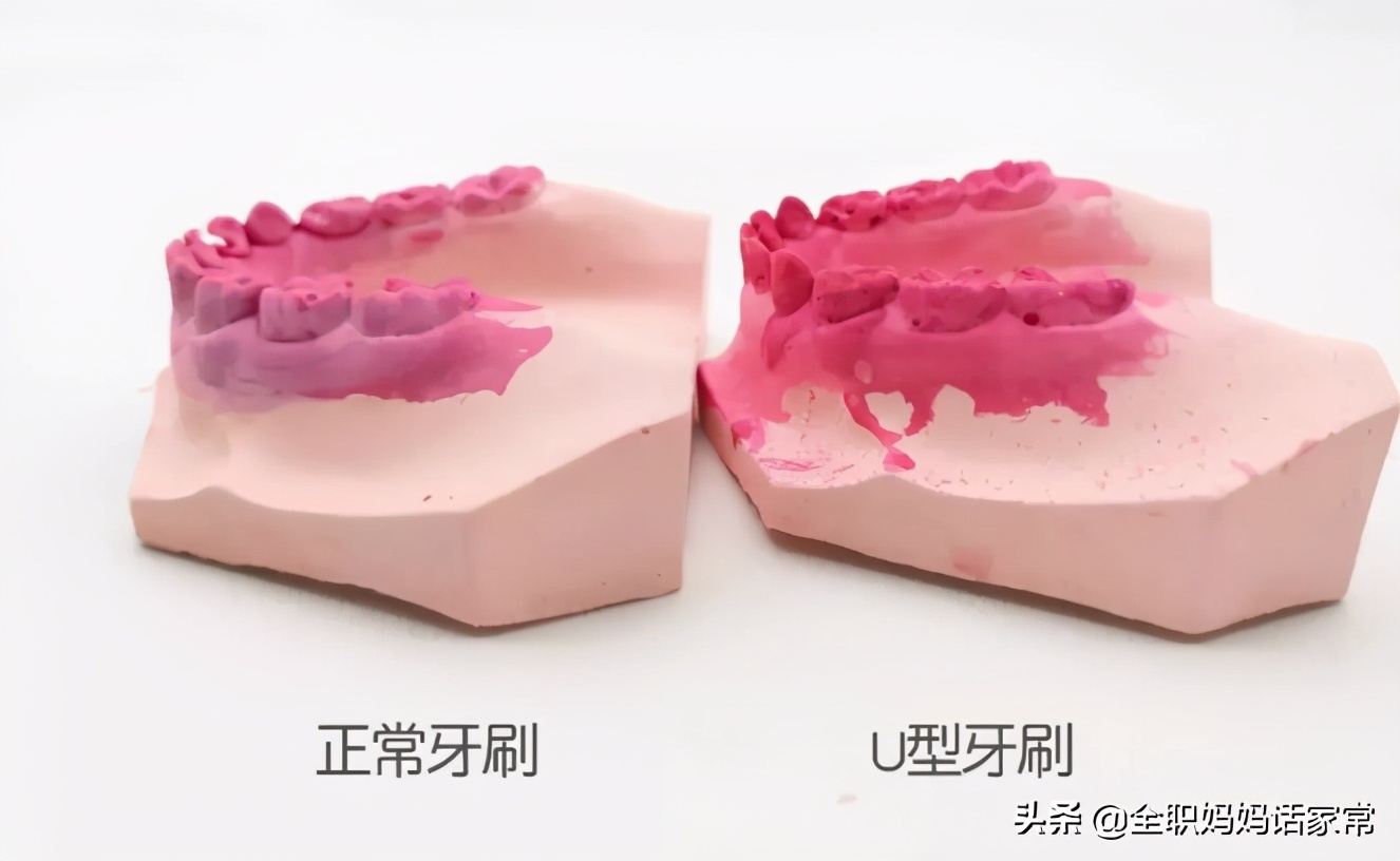 儿童硅胶u型牙刷好不好,儿童u型电动牙刷靠谱吗