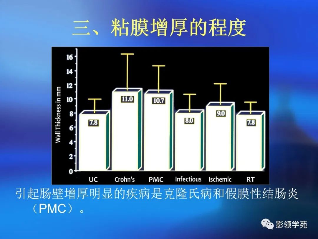 肠道内壁增厚,肠道扩张ct表现