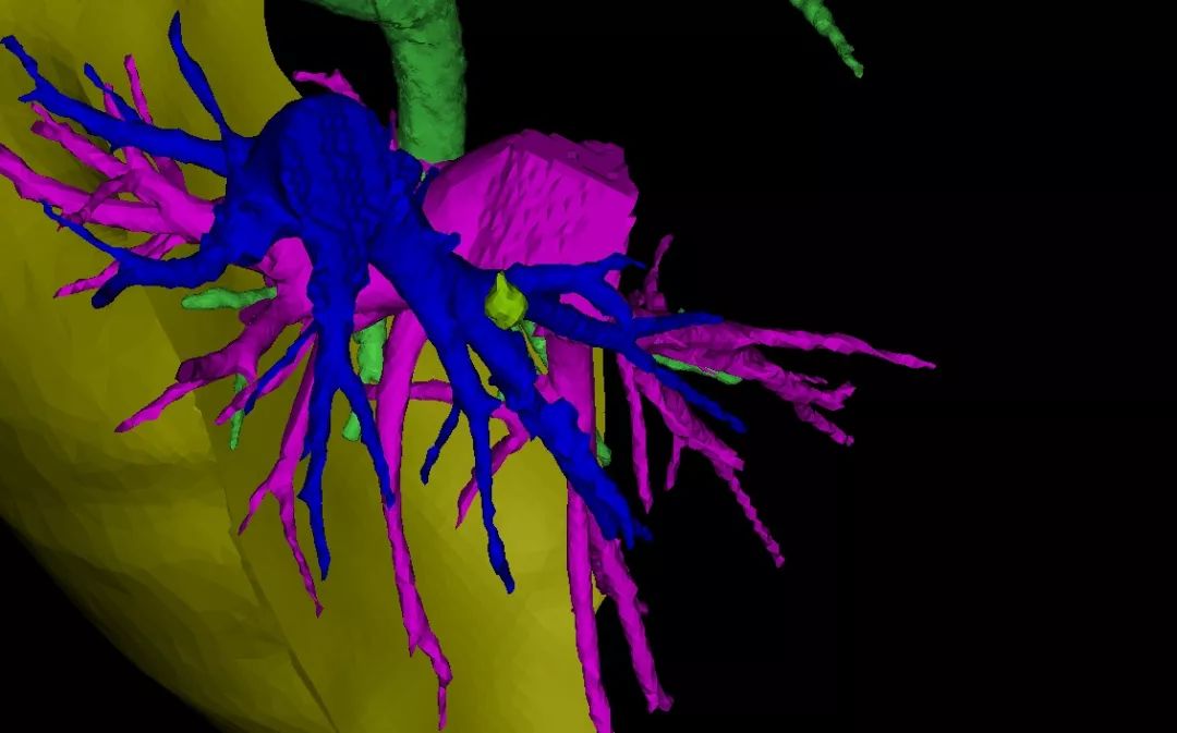 哈尔滨市肺磨玻璃结节权威医院,纳米机器人治疗肺结节