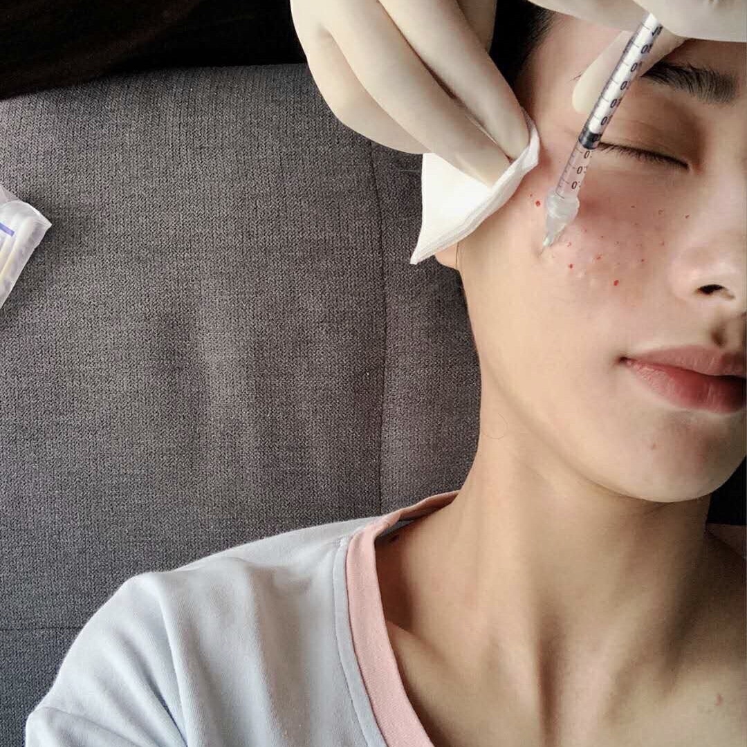 过敏怎么保养皮肤,春天皮肤过敏干红痒用什么护肤