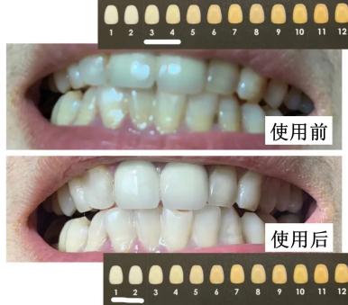 濂冲+鍙h厰棣欐按鎸佷箙鐣欓,濂介椈鍙h厰鍠烽浘棣欐按