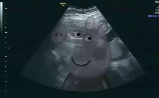 美白产品十大陷阱,各种美白成分的美白原理