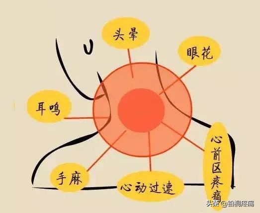 颈椎病疼痛怎么办缓解疼痛,得了颈椎病怎样治疗才最好治