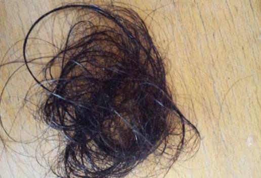 南昌市第12医院植发科,南昌第12医院植发效果怎么样