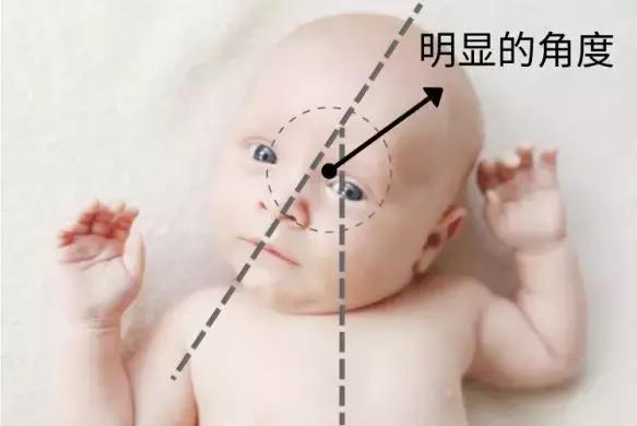 13岁儿童喜欢歪头矫正最佳方法,孩子写字歪头有什么工具可以矫正