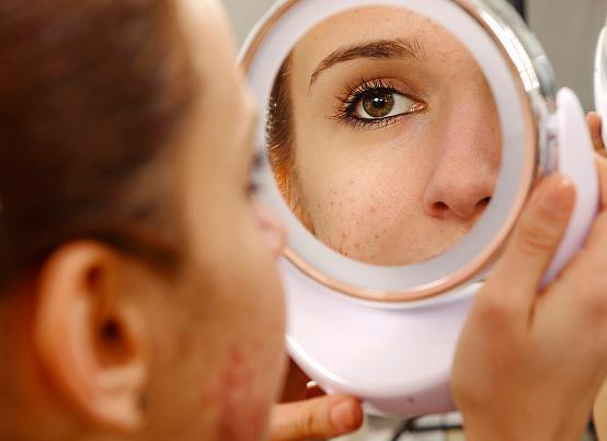 怎么样才可以恢复滤镜的自然妆,一周裸脸修复之后怎么用护肤品