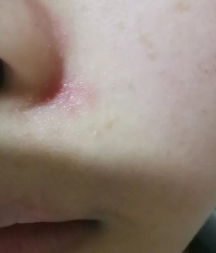 脸上的小瑕疵用什么护肤品比较好,脸部护肤的十大误区