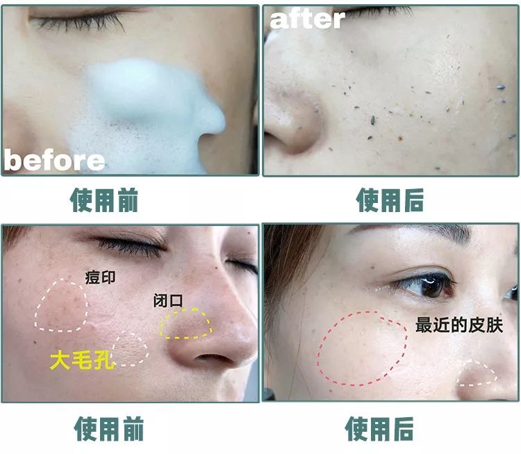 张韶涵护肤三周养皮,燕窝水漾嫩肤精华面膜包文婧