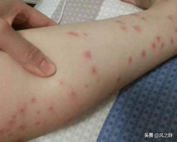 生活有妙招消灭蚊子,生活小妙招蚊子苍蝇