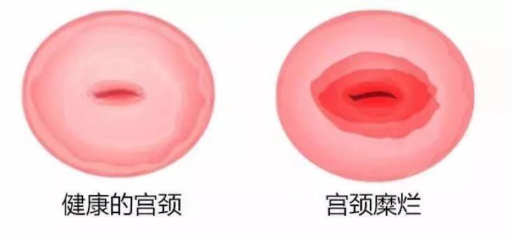 这种骇人听闻的“妇科病”，其实根本不用治