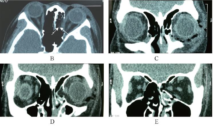 眼科医生和影像医生哪个好,真正的眼科医生