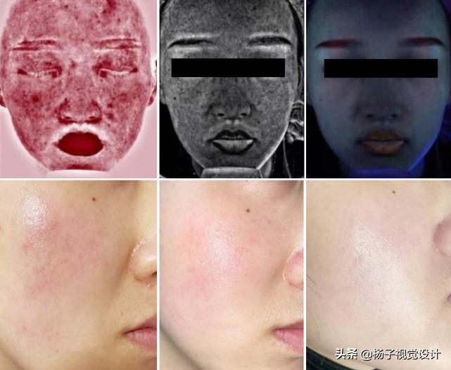 脸一遇热就发红发烫是敏感肌吗,天热脸上皮肤过敏怎么处理