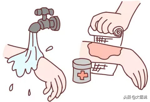 发生意外烫伤时的正确处理,被烧烫伤最有效的应急方法