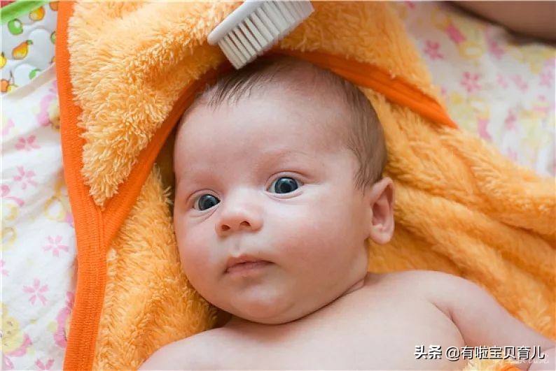 宝宝头发问题,宝宝头发少头发黄怎么办