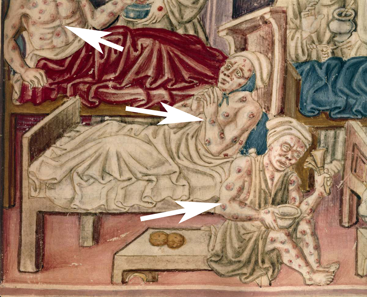 土拨鼠有什么病菌,土拨鼠携带致命鼠疫