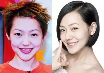 哪些明星整牙后像整容,明星整牙变美了