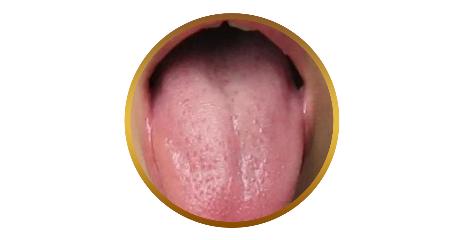 舌头有舌象是什么原因,怎么判断宝宝舌象是否正常