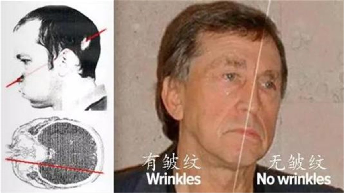 他把头伸进粒子加速器,被接近光速的质子束“轰击”,最后怎样了