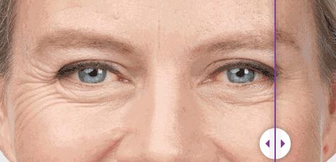 抗氧化是抗老的意思吗,抗氧化抗衰老什么意思