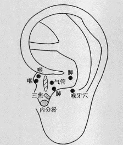 总觉得自己得了食道癌怎么办,别怀疑自己得了食道癌