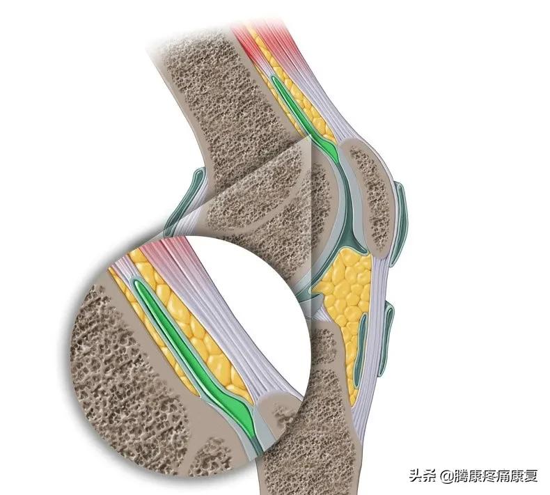 髌股关节疼痛综合症的检测方法,髌股关节疼痛综合征