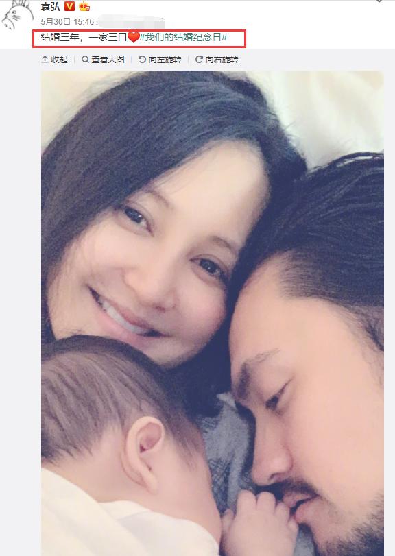 宝宝手被叮成“猪蹄”,很可能是你没注意这些,张歆艺防蚊有妙招