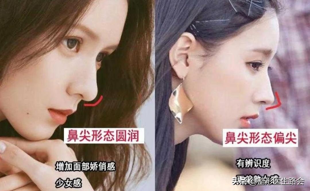 直鼻微翘怎么整,直鼻微翘怎么做出来自然又好看