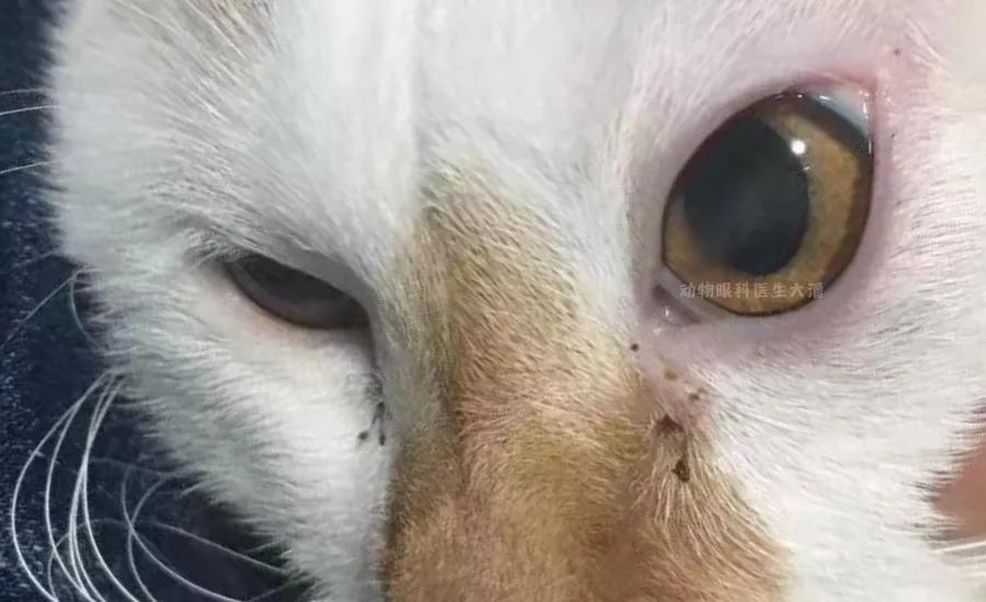 眼角膜溃烂能做角膜移植手术吗,双眼角膜溃疡