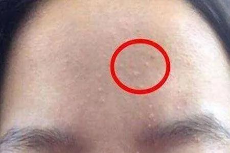 床单久睡不晒螨虫“成堆”?教你1招,不用洗不用晒,轻松除螨虫