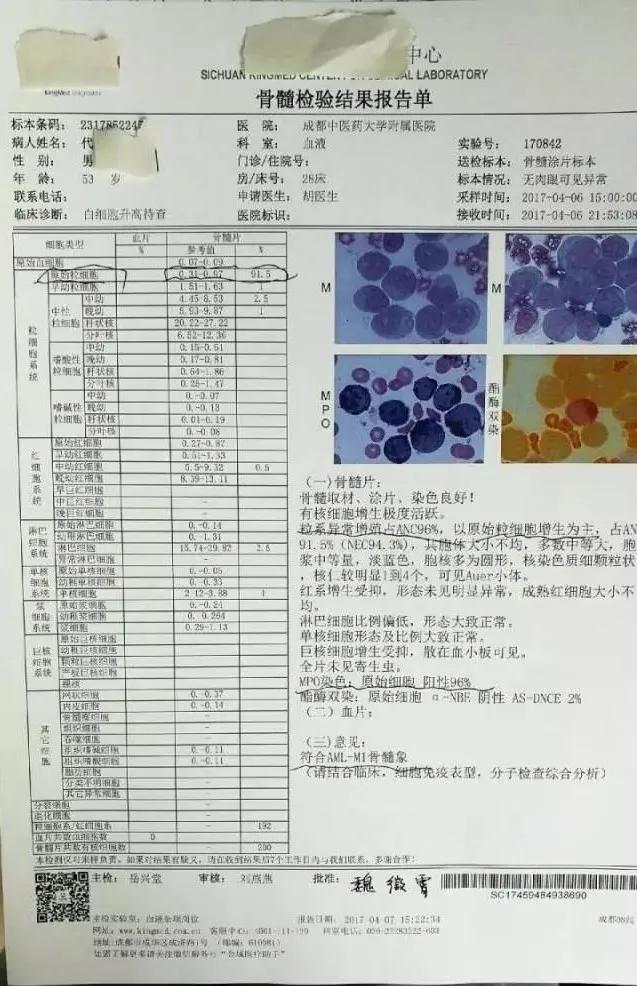 骨髓涂片中幼粒细胞17%是什么原因,骨髓涂片原始粒细胞正常值是多少