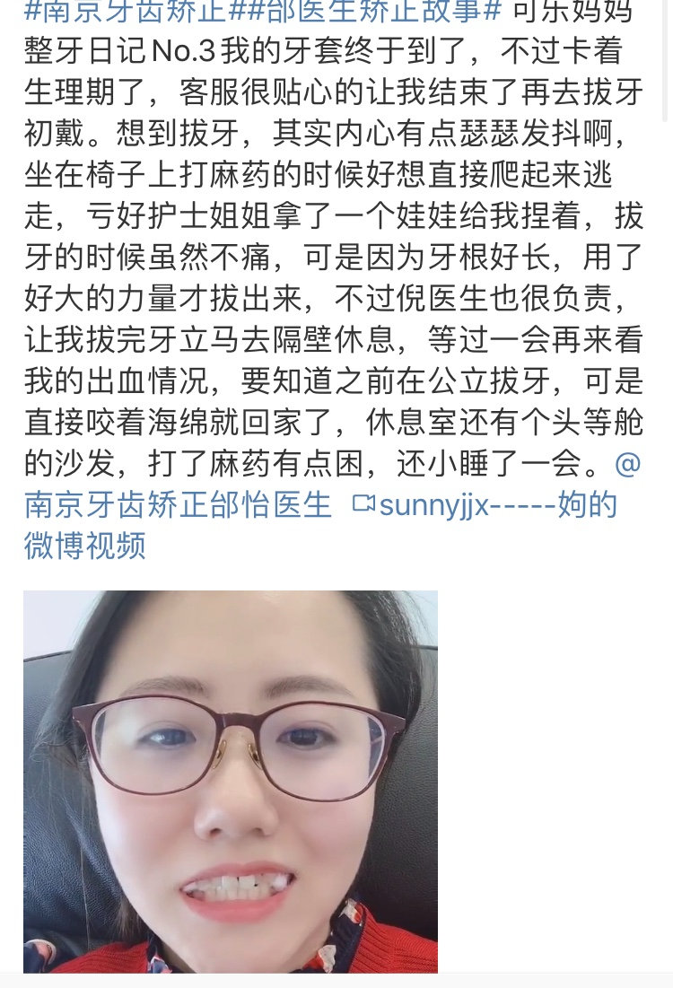 正畸医生邰怡的作品,南京牙齿矫正邰医生