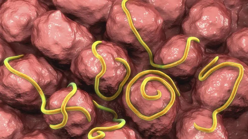 屁屁老是痒痒痒痒痒痒痒痒?蛲虫病了解一下