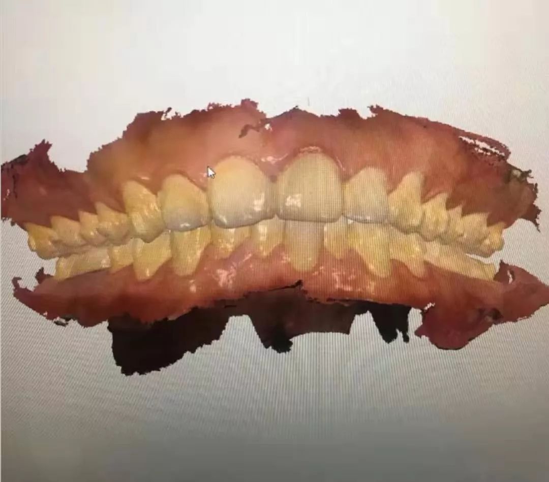 重启后的我,重启后时间变了是为什么