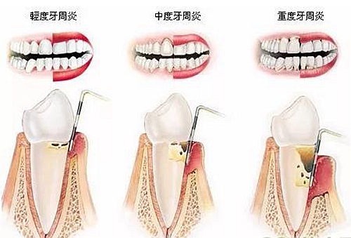 口腔门诊如何在疫情当下开新破局,疫情口腔停诊蛀牙怎么办