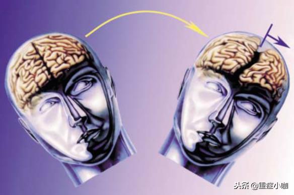 弥漫性轴索损伤和脑干挫伤,弥漫性轴索损伤有必要救吗