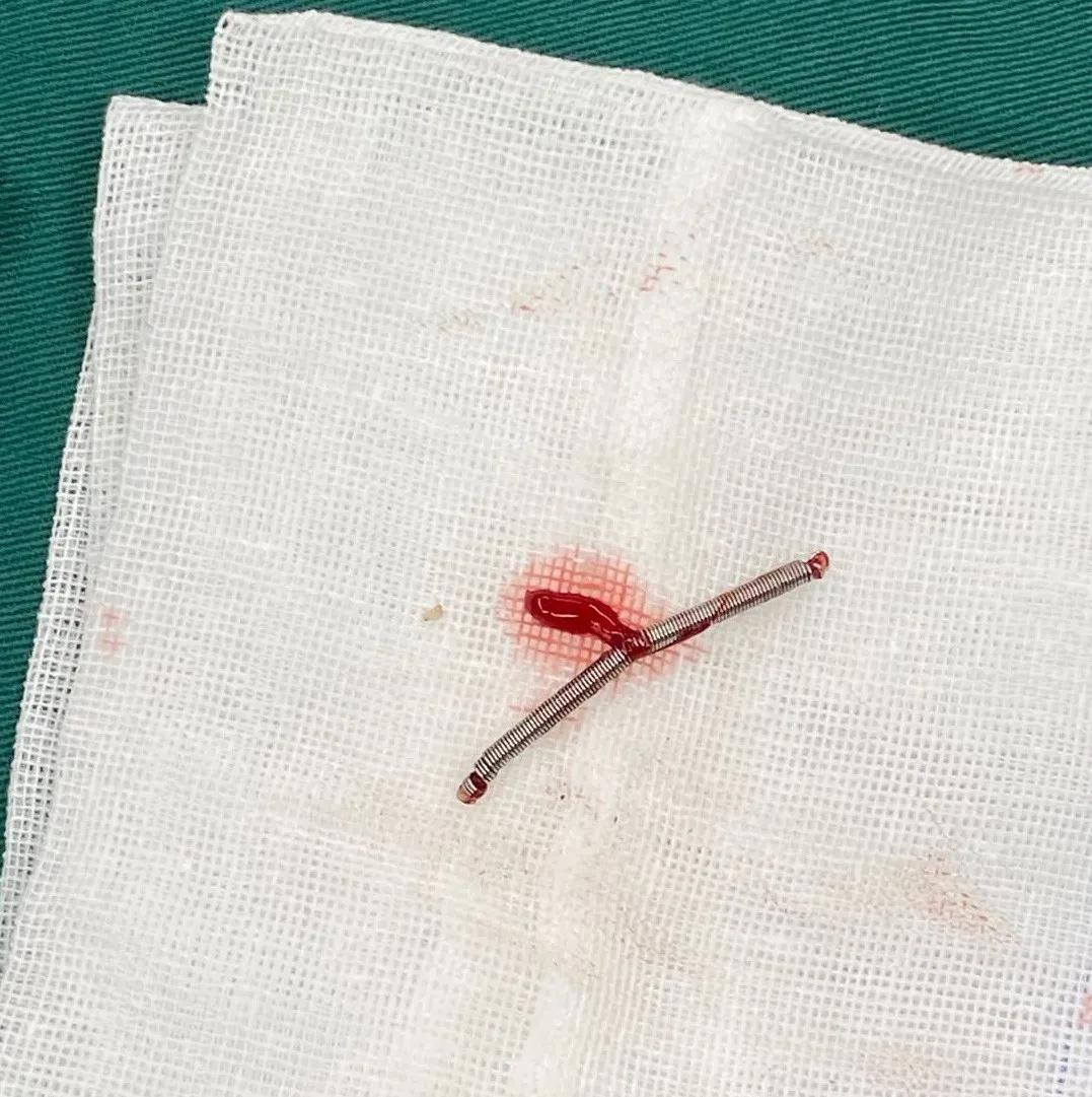 亳州市妇幼保健院妇产科开展宫腔镜手术为患者排忧解难