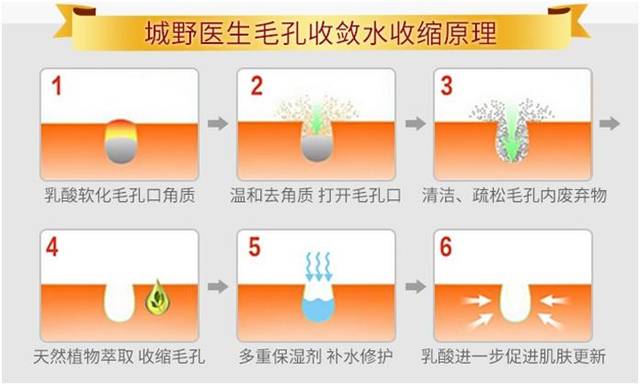 干敏肌适合的毛孔收敛水,收敛水能消痘吗