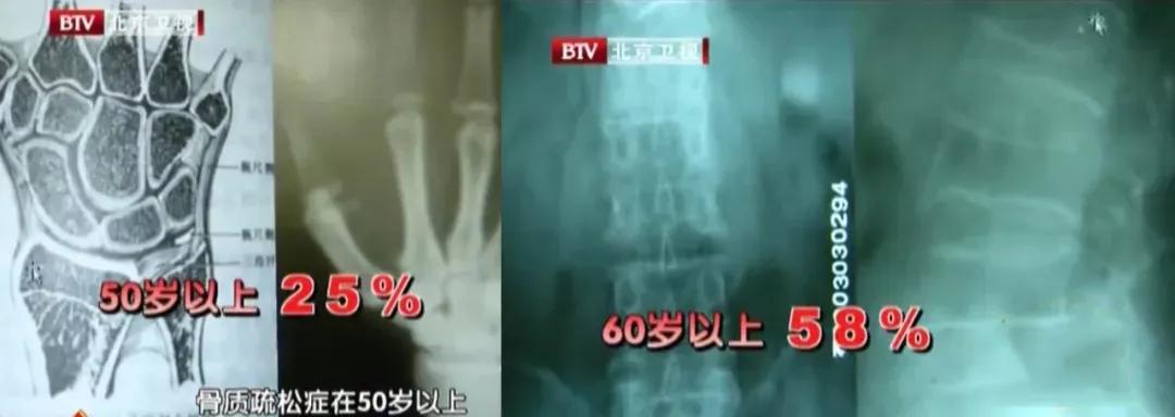吃这3种食物补钙最快最好,八种补钙食物胜过吃钙片