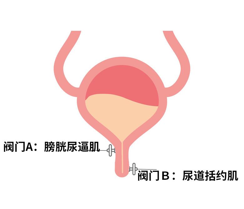 憋尿太久膀胱会不会破,得膀胱过度症憋尿能憋多久