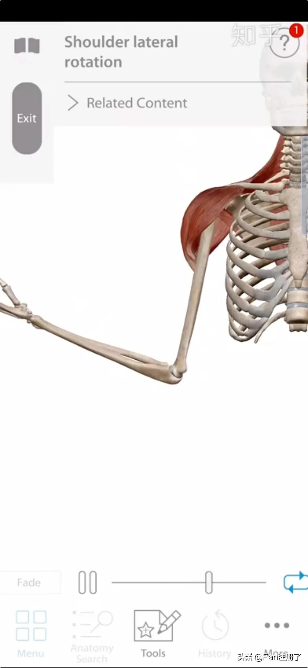 肩痛肩袖损伤针刀治疗,肩痛肩关节活动受限用什么药