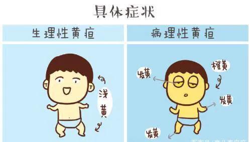 新生儿黄疸是吃药还是照灯,黄疸照蓝光好还是晒太阳好